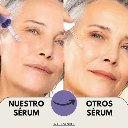 Sérum Facial Antiarrugas™ -  Tratamiento antiedad, piel seca o con manchas